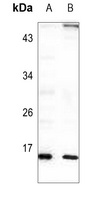 Anti-RPL22 Antibody