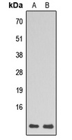 Anti-RPL39 Antibody