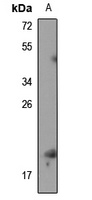RPS19BP1 antibody