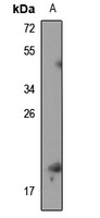 Anti-RPS19BP1 Antibody