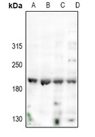 Nogo antibody