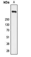 Anti-Ryanodine Receptor 2 (Phospho-S2808) Antibody