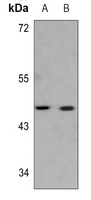 Serpin B3/4 antibody