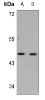 Anti-Serpin B3/4 Antibody