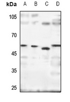 SH2D4A antibody