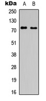 SLC6A16 antibody