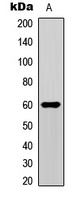 Anti-SMAD1/9 (Phospho-S465/467) Antibody