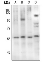 Anti-SMAD2 (Phospho-S467) Antibody