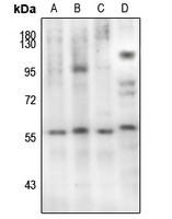 Smad2 (phospho-S467) antibody