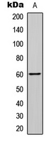 Anti-SMAD2 (Phospho-S465) Antibody