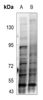 Anti-SMAD3 (Phospho-T179) Antibody