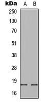 alpha synuclein (phospho-S129) antibody