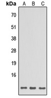 Anti-SPINK6 Antibody