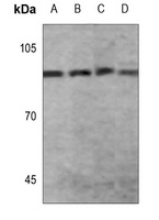 Anti-STAT2 (Phospho-Y690) Antibody