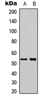 Anti-STEAP3 Antibody