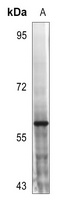 Anti-MST1/2 (Phospho-T183) Antibody