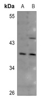 CD134 antibody