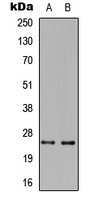 CD258 antibody