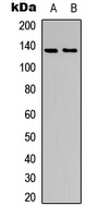 Anti-ACK1 (Phospho-Y284) Antibody