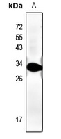 Anti-cTnI Antibody