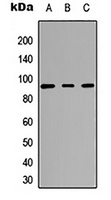 CARK antibody