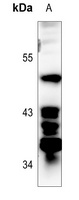 Anti-p53 (Phospho-S392) Antibody
