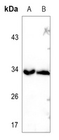 TRADD antibody