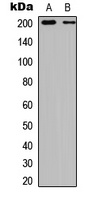 Anti-TSC2 (Phospho-S939) Antibody
