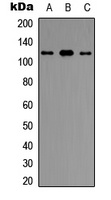 UBE3C antibody