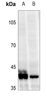 Vitamin D3 Receptor (phospho-S208) antibody