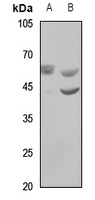 WASF3 antibody