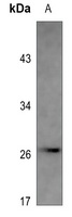 Anti-PS1D Antibody