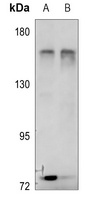 Anti-RACK7 Antibody