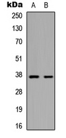 MARCH5 antibody