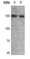 Anti-Alpha-adducin (Phospho-T445) Antibody