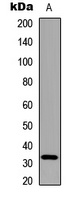 Anti-Adiponectin Antibody