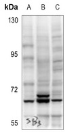Anti-AKT (Phospho-S473) Antibody