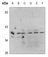 Anti-PRAS40 (Phospho-T246) Antibody