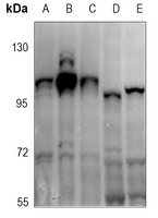ATP1A1 (phospho-S16) antibody