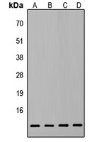 ATP5L2 Rabbit Polyclonal Antibody