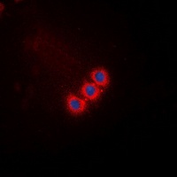 ATP5L2 Rabbit Polyclonal Antibody