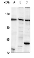 BCR antibody