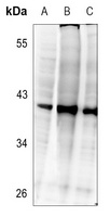 C/EBP beta (phospho-T235) antibody