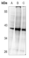 Anti-C/EBP beta (Phospho-T235) Antibody
