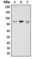 Anti-IKK alpha/beta (Phospho-S176/177) Antibody