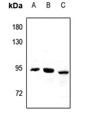 Anti-CPT1B Antibody