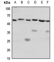 Anti-CD184 Antibody