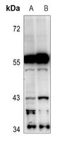 Cytochrome (phospho-450 2C19) antibody