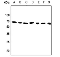 Anti-DDX52 Antibody