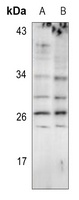 Anti-EIF4E3 Antibody
